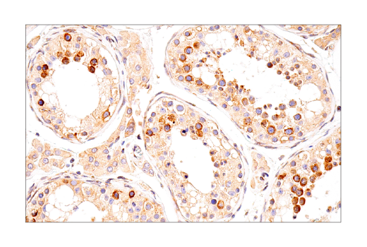 Immunohistochemistry Image 10: UBAP2L (E5X4E) Rabbit Monoclonal Antibody