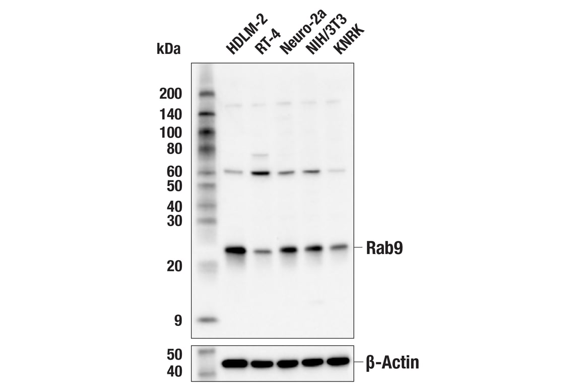 Western Blotting Image 1: Rab9A (E2I3T) Mouse mAb