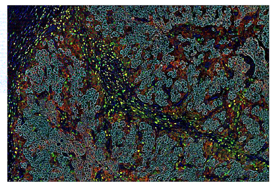 Immunohistochemistry Image 7: TCF1/TCF7 (C63D9) & CO-0006-594 SignalStar<sup>™</sup> Oligo-Antibody Pair