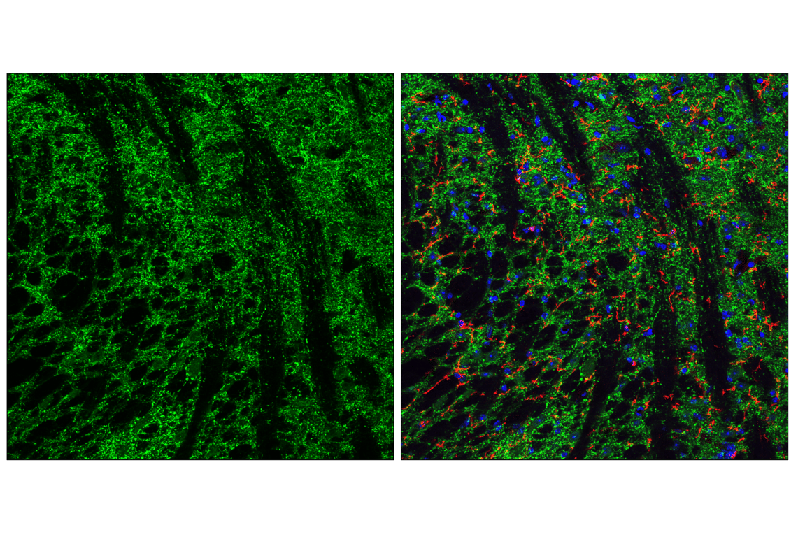 Immunofluorescence Image 4: VGAT Antibody