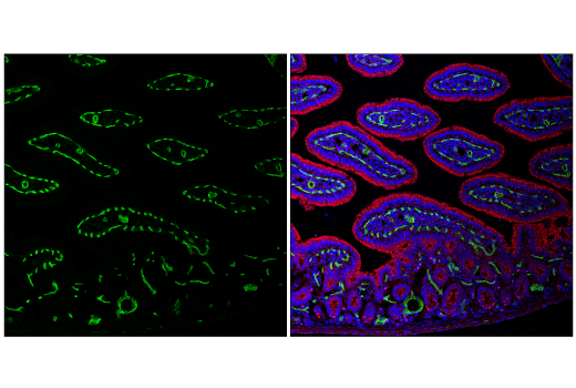 Immunofluorescence Image 1: PLVAP (E9W8D) Rabbit Monoclonal Antibody