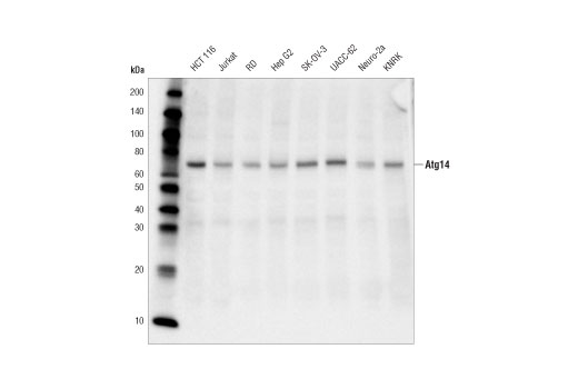 undefined Image 11: Beclin-1 Complex Antibody Sampler Kit