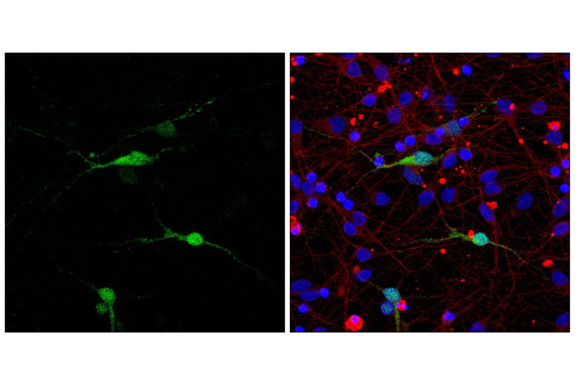 Immunofluorescence Image 1: Calbindin (D1I4Q) Rabbit Monoclonal Antibody