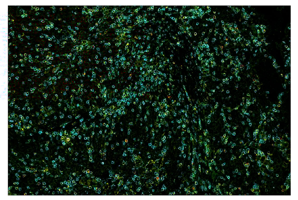 Immunohistochemistry Image 6: PD-1 (Intracellular Domain) (D4W2J) & CO-0008-488 SignalStar<sup>™</sup> Oligo-Antibody Pair