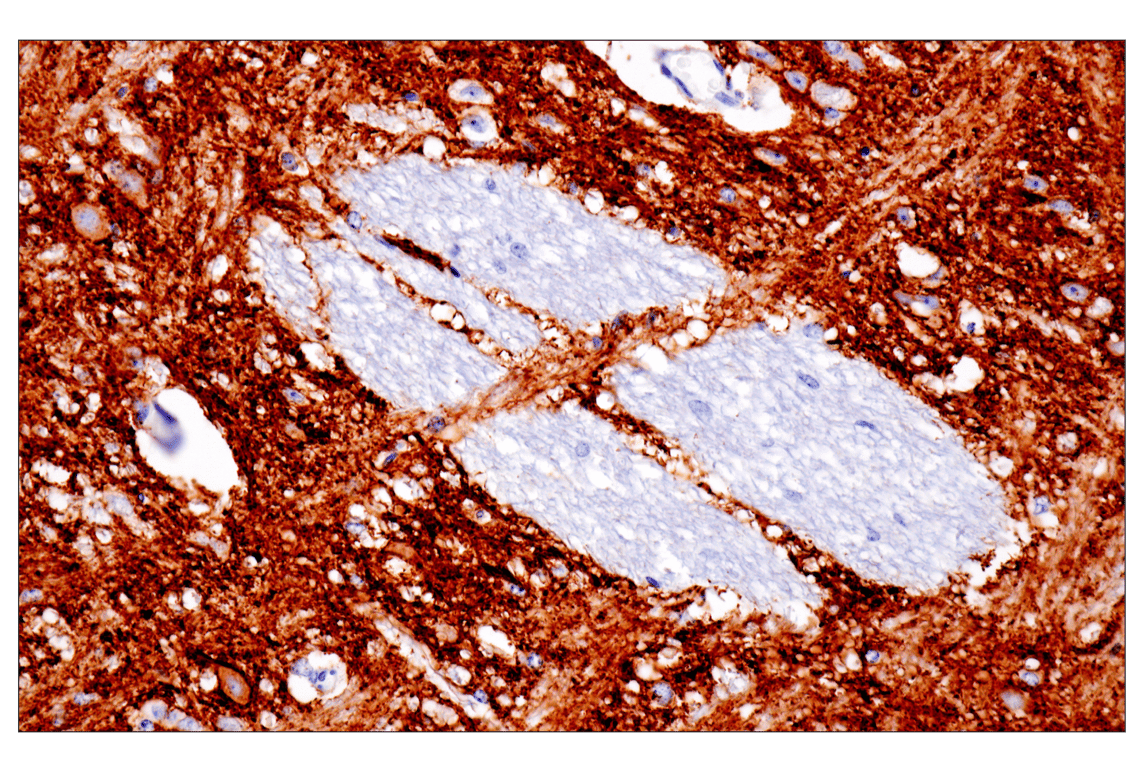 undefined Image 4: Presynaptic Vesicle Cycle Antibody Sampler Kit