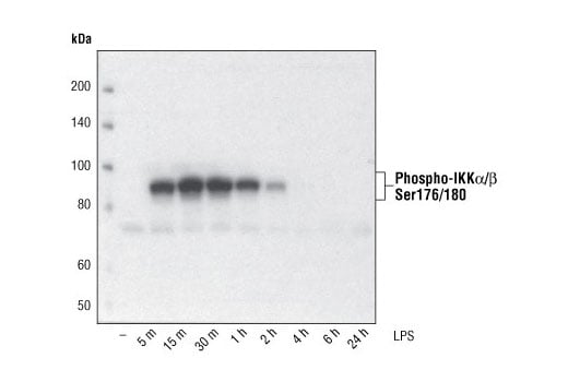undefined Image 2: NF-κB Pathway Antibody Sampler Kit