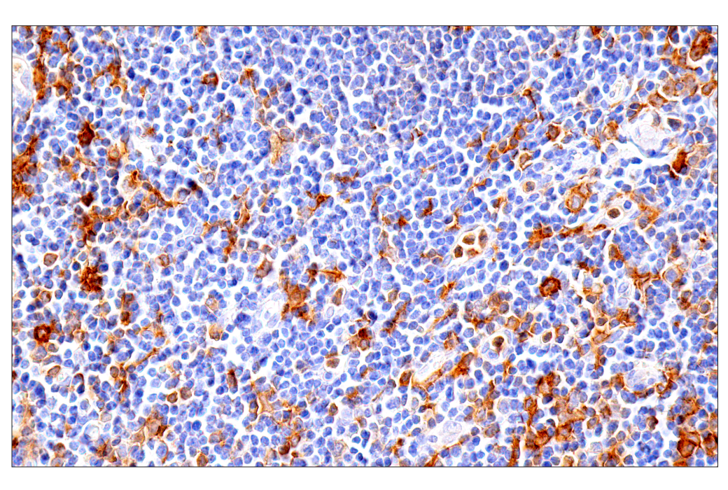 Immunohistochemistry Image 5: GM-CSF Receptor alpha (E8Z3S) Rabbit Monoclonal Antibody