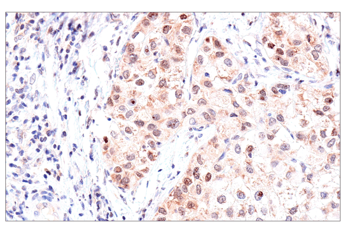 Immunohistochemistry Image 3: ADAR1 p150 Isoform (E6U1U) Rabbit Monoclonal Antibody (BSA and Azide Free)