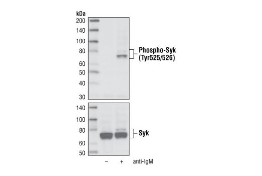 Western Blotting Image 1: Phospho-Syk (Tyr525/526) (C87C1) Rabbit mAb