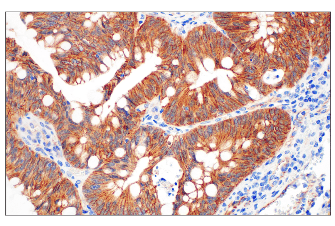 Immunohistochemistry Image 2: beta-Catenin (D10A8) Rabbit Monoclonal Antibody