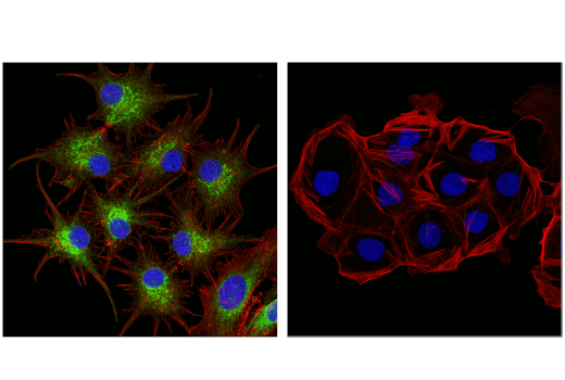 Immunofluorescence Image 1: MLANA/MART-1 (E9Q4O) Rabbit Monoclonal Antibody