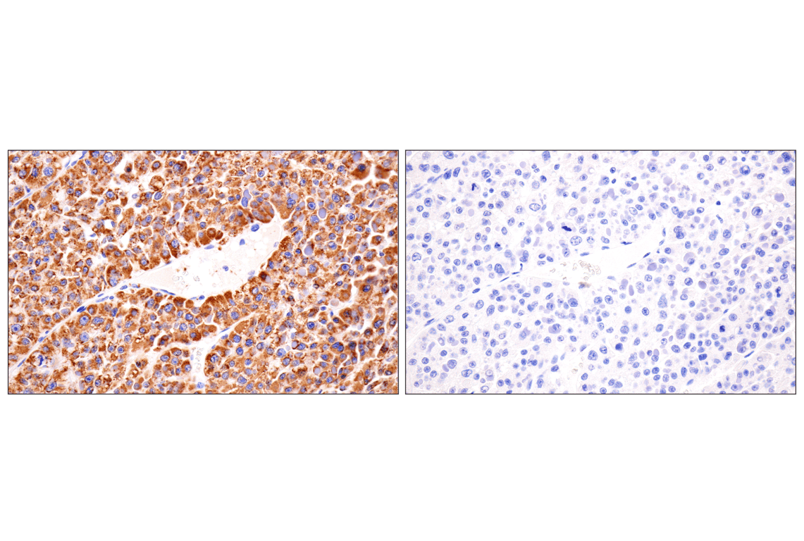 Immunohistochemistry Image 14: AMACR (F7T6V) Rabbit Monoclonal Antibody