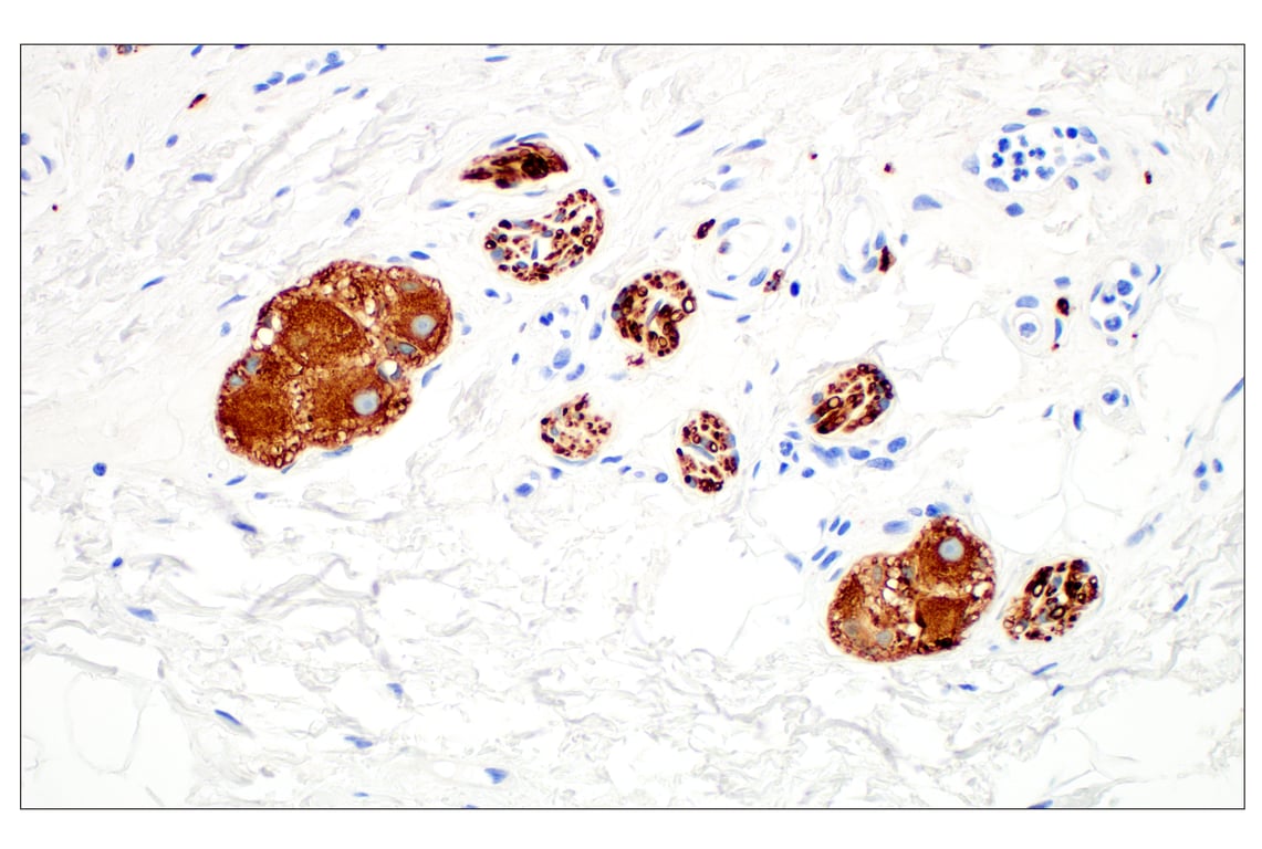 Immunohistochemistry Image 3: beta3-Tubulin (E9F3E) Mouse Monoclonal Antibody