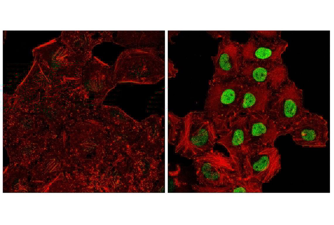 Immunofluorescence Image 1: c-Fos (E2I7R) Rabbit Monoclonal Antibody (BSA and Azide Free)