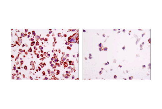 Immunohistochemistry Image 2: Integrin beta1 (D2E5) Rabbit Monoclonal Antibody (BSA and Azide Free)