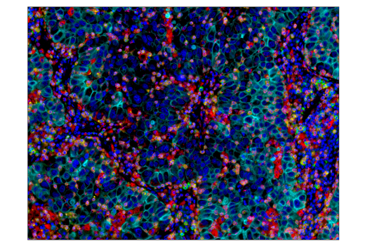 Immunohistochemistry Image 5: CD68 (D4B9C) Rabbit Monoclonal Antibody (BSA and Azide Free)