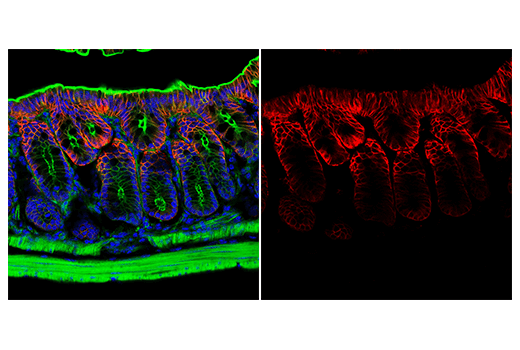 Immunofluorescence Image 2: AQP4 (D1F8E) Rabbit Monoclonal Antibody (Alexa Fluor<sup>®</sup> 647 Conjugate)