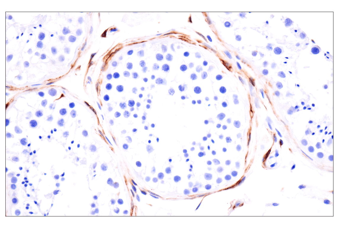 Immunohistochemistry Image 11: Desmin (F5V4I) Rabbit Monoclonal Antibody (BSA and Azide Free)