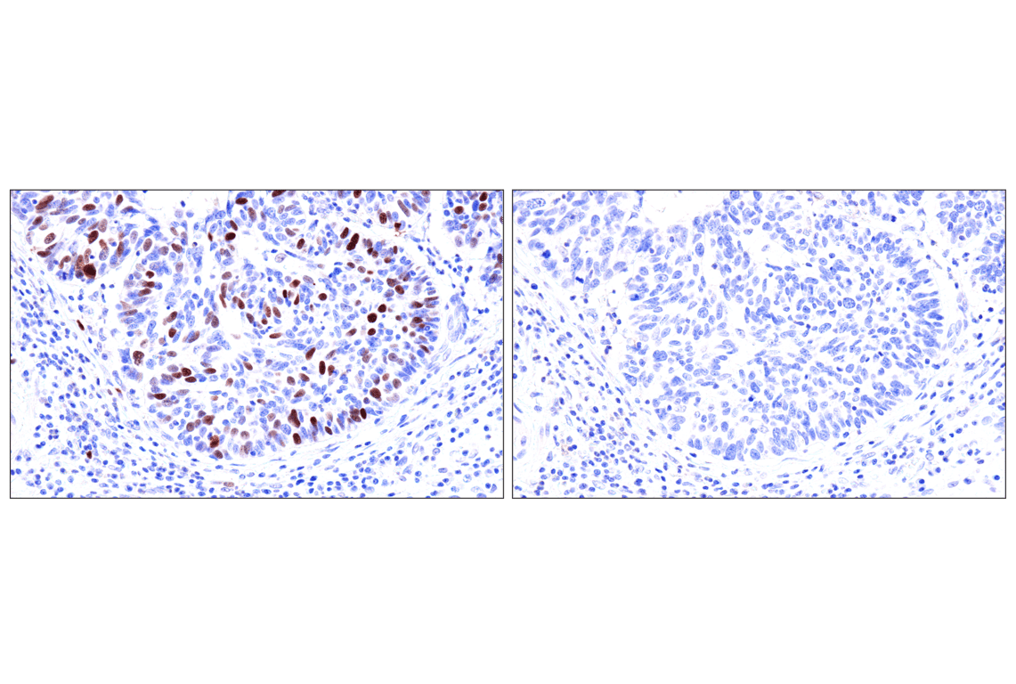 Immunohistochemistry Image 15: Phospho-NPM1 (Thr199) (E4C7S) Rabbit Monoclonal Antibody