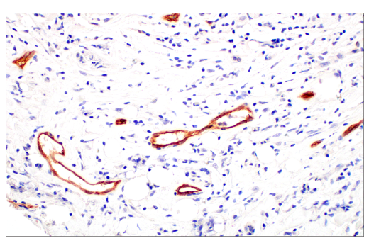 Immunohistochemistry Image 2: PLVAP (E3X9D) Rabbit Monoclonal Antibody
