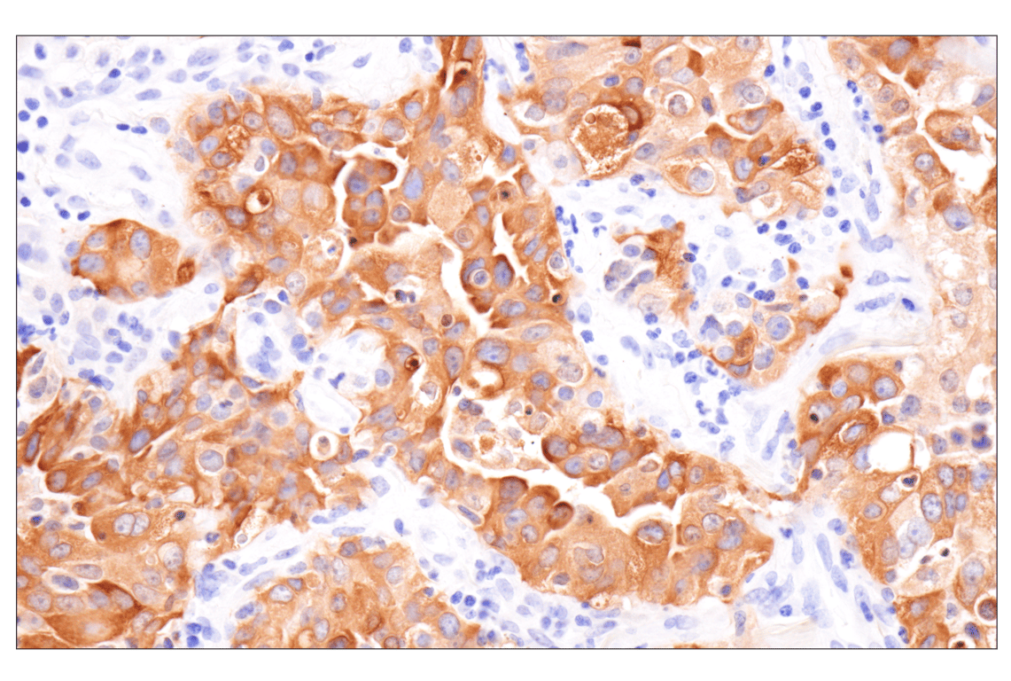 Immunohistochemistry Image 3: Involucrin (F9C3C) Rabbit Monoclonal Antibody