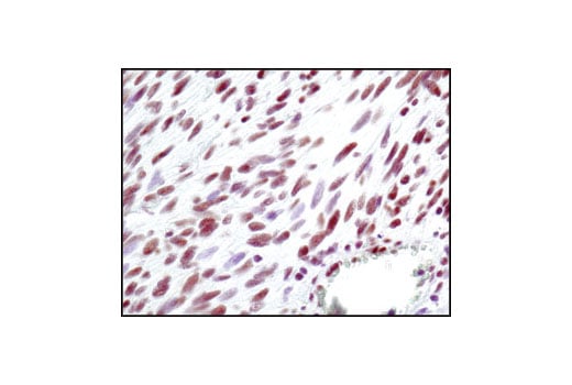 Immunohistochemistry Image 4: Ku80 (C48E7) Rabbit Monoclonal Antibody