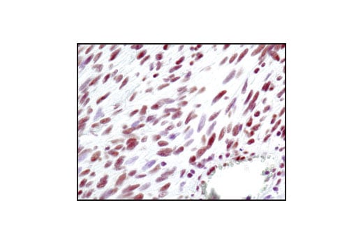 undefined Image 17: Double Strand Breaks (DSB) Repair Antibody Sampler Kit