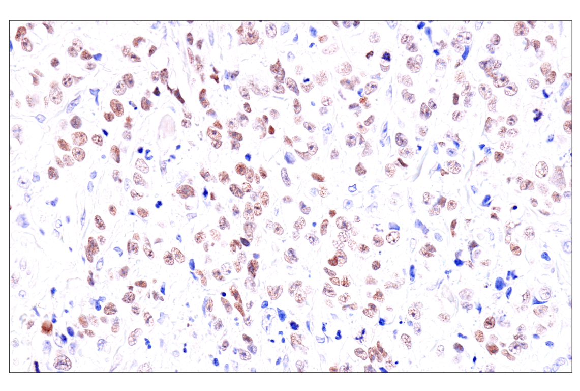 Immunohistochemistry Image 7: GATA-6 (D61E4) XP<sup>®</sup> Rabbit mAb