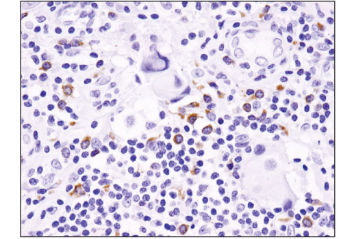 Immunohistochemistry Image 1: BLNK (D3P2H) Rabbit Monoclonal Antibody (BSA and Azide Free)