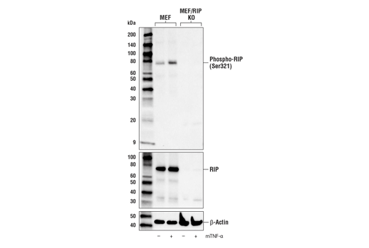 Western Blotting Image 3: Phospho-RIP (Ser321) (E9K2A) Rabbit Monoclonal Antibody (BSA and Azide Free)
