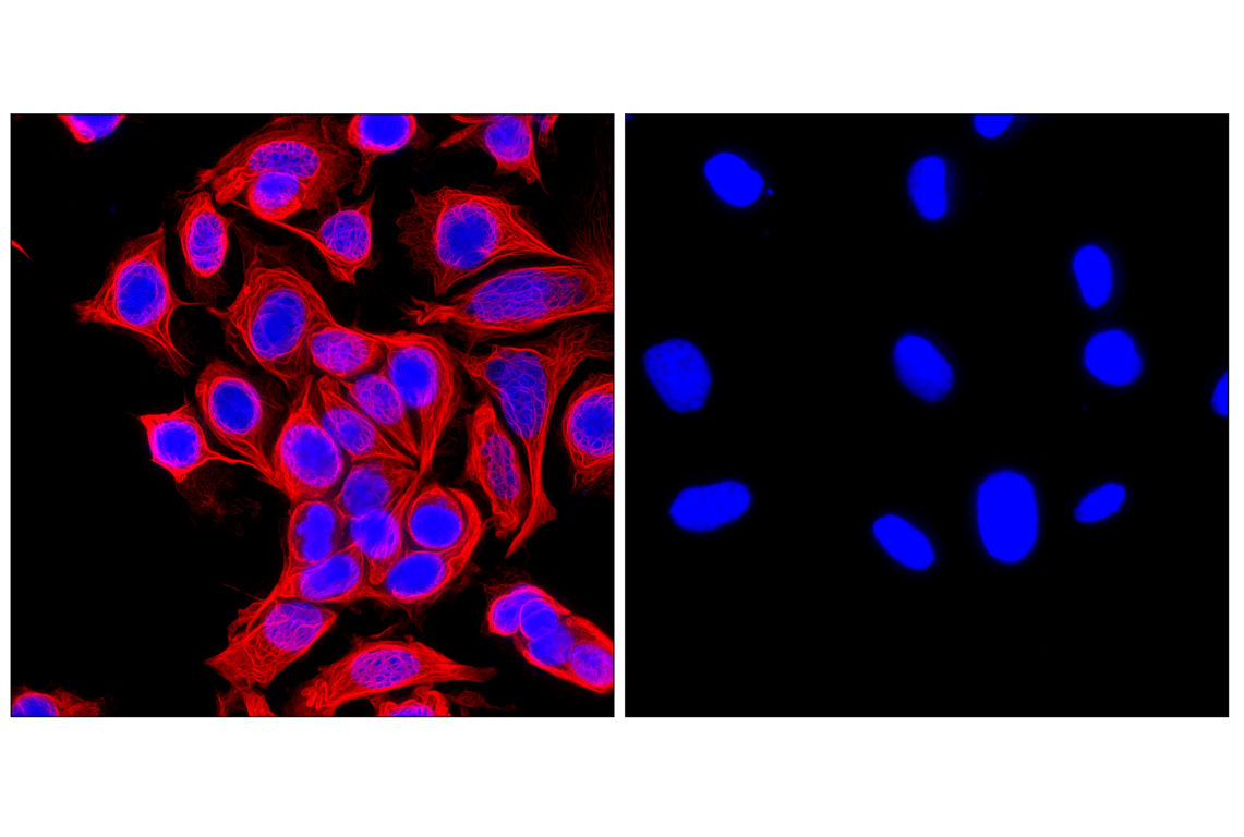 Immunofluorescence Image 1: Keratin 8/18 (C51) Mouse Monoclonal Antibody (Alexa Fluor<sup>®</sup> 555 Conjugate)