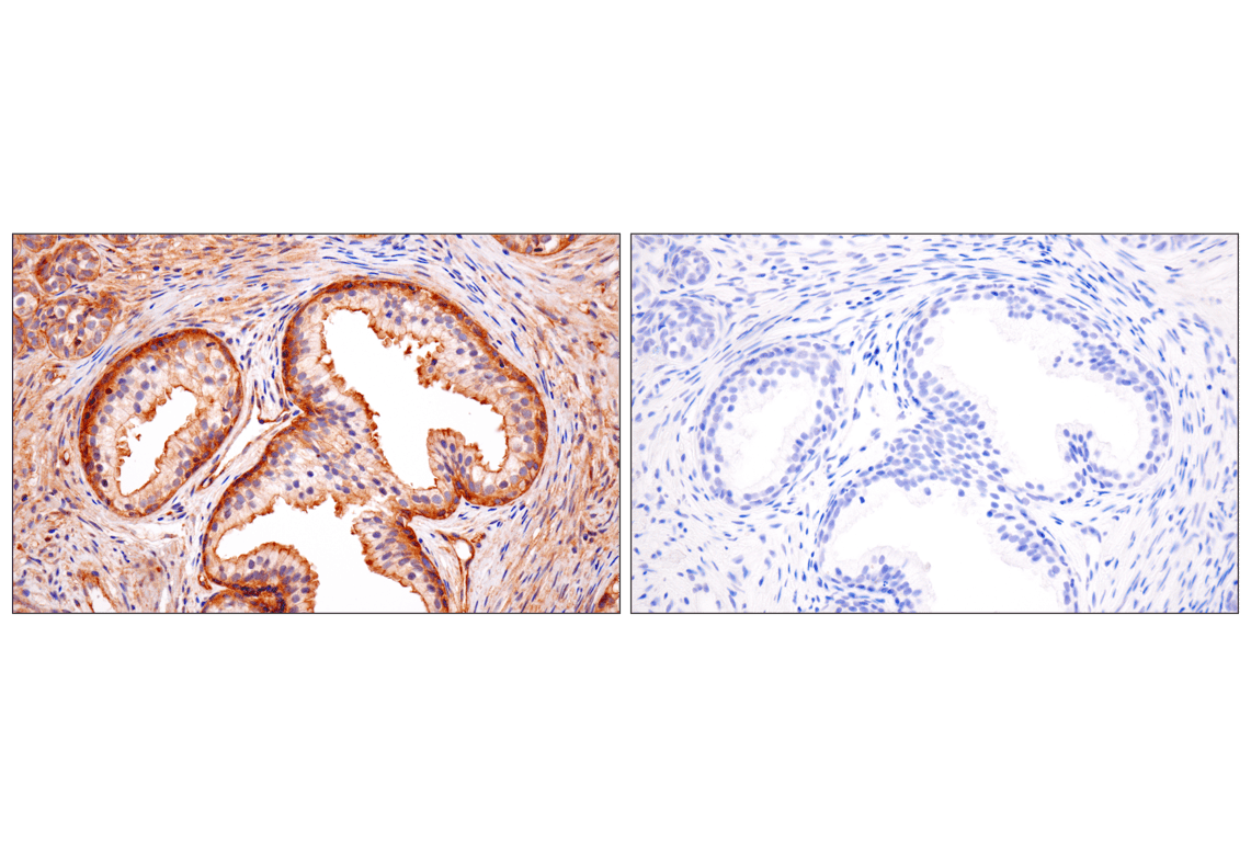 Immunohistochemistry Image 11: Numb (F2P3P) Rabbit Monoclonal Antibody