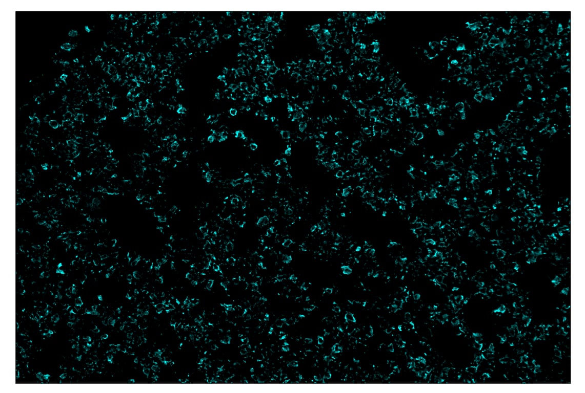 Immunohistochemistry Image 5: Pan-Keratin (Type I) (E6S1S) & CO-0072-750 SignalStar<sup>™</sup> Oligo-Antibody Pair