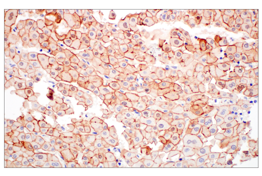 Immunohistochemistry Image 1: Villin-1 (CWWB1) Mouse Monoclonal Antibody