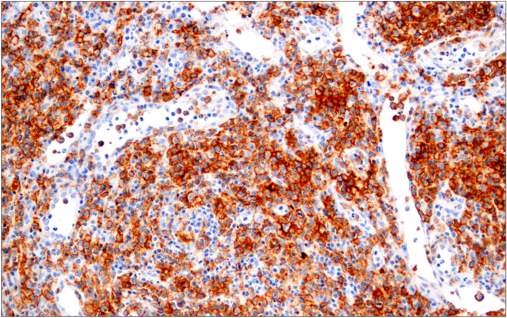 Immunohistochemical analysis of paraffin-embedded  spleen using FoxP3 (D6O8R) Rabbit mAb