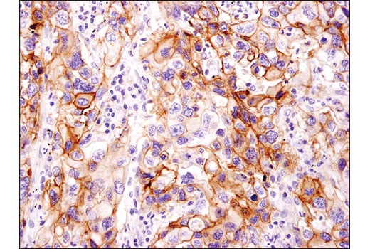 Immunohistochemistry Image 1: EphA2 (D4A2) Rabbit Monoclonal Antibody (BSA and Azide Free)