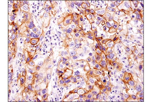 Immunohistochemistry Image 1: EphA2 (D4A2) XP<sup>®</sup> Rabbit mAb (BSA and Azide Free)