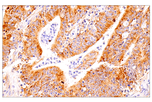 Immunohistochemistry Image 2: G3BP1 (E9G1M) Rabbit Monoclonal Antibody
