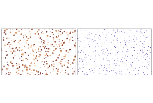 Immunohistochemistry Image 3: TNFRSF8/CD30 (E7E4D) Rabbit Monoclonal Antibody (BSA and Azide Free)