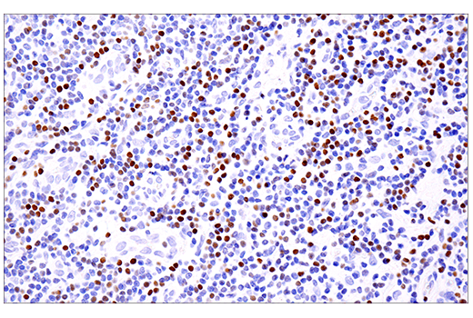 Immunohistochemistry Image 6: SATB1 (E5Z3U) Rabbit Monoclonal Antibody