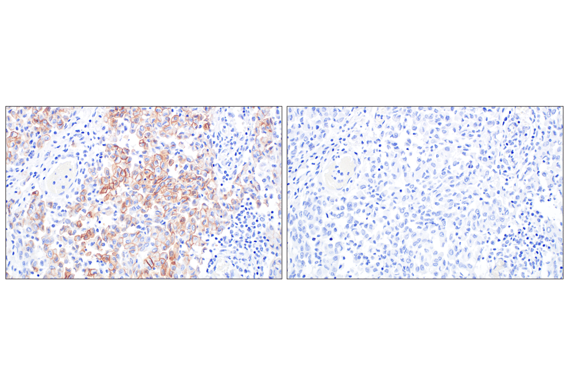 Immunohistochemistry Image 3: UPK3B (DBRRM3.66) Rabbit Monoclonal Antibody