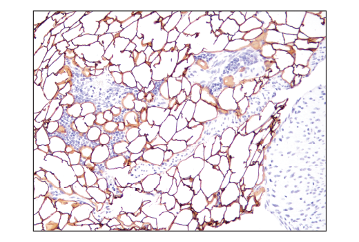 Immunohistochemistry Image 5: Perilipin-1 (D1D8) Rabbit Monoclonal Antibody (BSA and Azide Free)