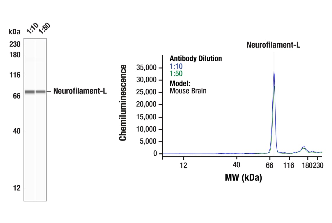 undefined Image 1: Neurofilament-L (DA2) Mouse Monoclonal Antibody