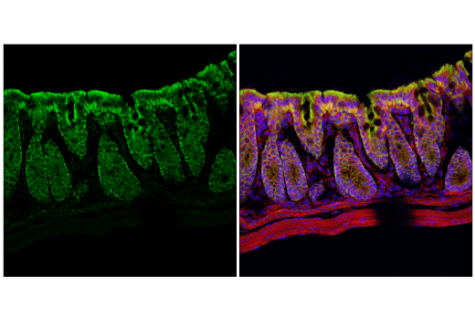 Immunofluorescence Image 2: MCU (D2Z3B) Rabbit Monoclonal Antibody