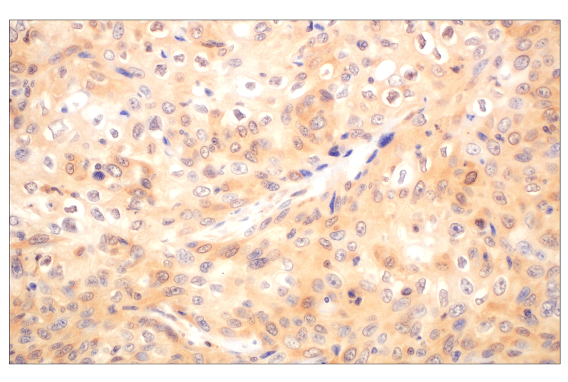 Immunohistochemistry Image 6: Galectin-8/LGALS8 (F9O3T) Rabbit Monoclonal Antibody
