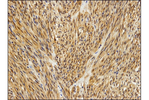 Immunohistochemistry Image 2: PKC theta (E1I7Y) Rabbit Monoclonal Antibody (BSA and Azide Free)