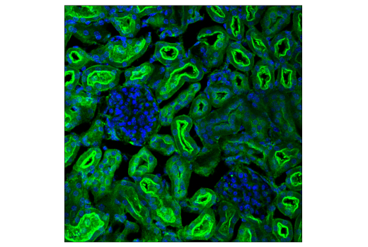 Immunofluorescence Image 3: PICALM (E3J9R) Rabbit Monoclonal Antibody