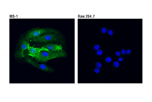Immunofluorescence Image 1: VCAM-1 (D8U5V) Rabbit Monoclonal Antibody