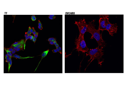 Immunofluorescence Image 1: PC2 (D1E1S) Rabbit Monoclonal Antibody
