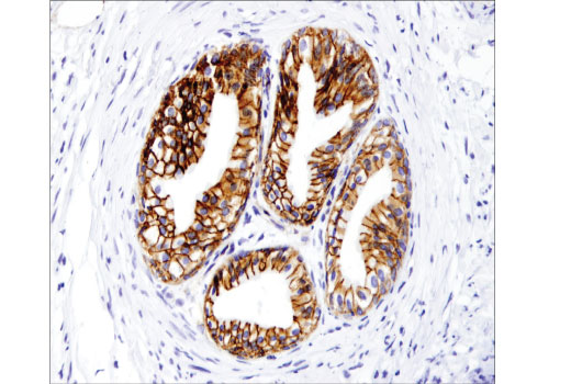 Immunohistochemistry Image 4: gamma-Catenin (D9M1Q) Rabbit Monoclonal Antibody